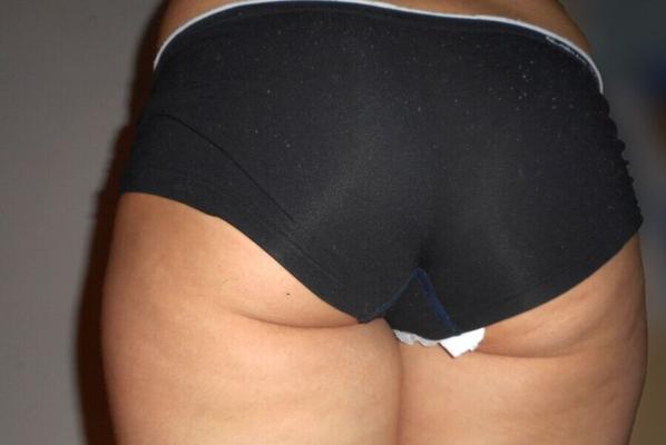 Mon cul moelleux / My cheeky bubble ass
