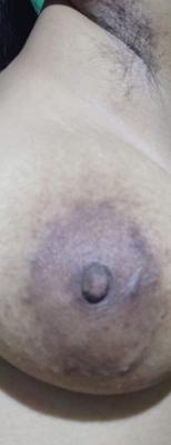 My hairy indian wife s brown nipples