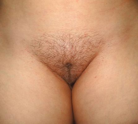 Trim pussy