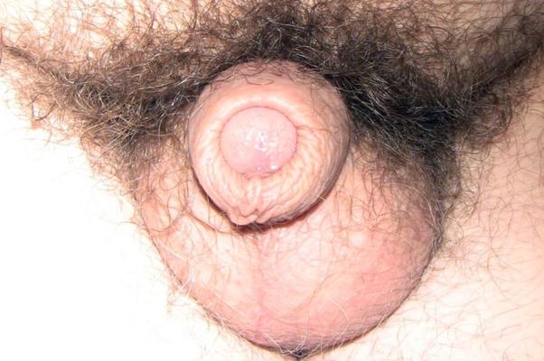Little Tiny Pathetic Hairy Cock