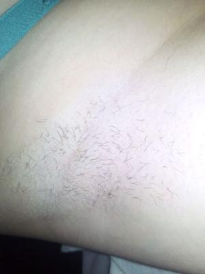 Gf pits