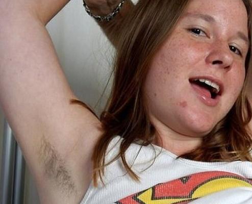 Hairy Alexia