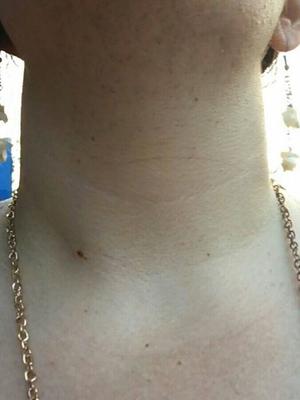Hairy Chin Girl