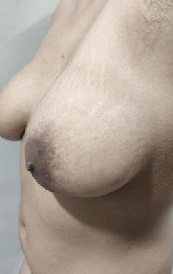 Indian hairy white wife with big nipples