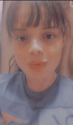 - Hairy lovely Argie Patty